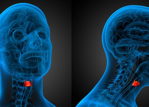 Laryngeal cancer