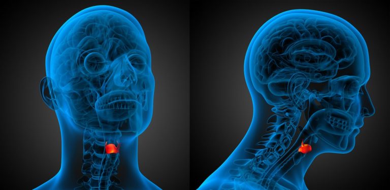 Laryngeal cancer